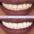 Elims AM & PM Reflection Toothpaste & Teeth Whitening Mask Set